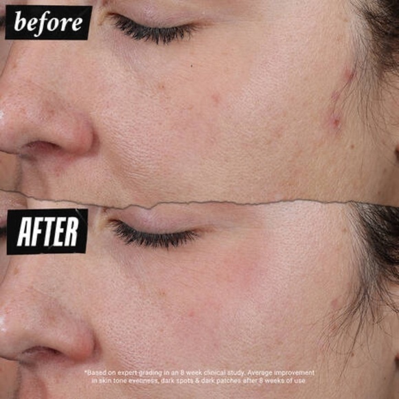 Kiehl's Auto-Tone Discoloration & UV Solution - NIB - Picture 4 of 8